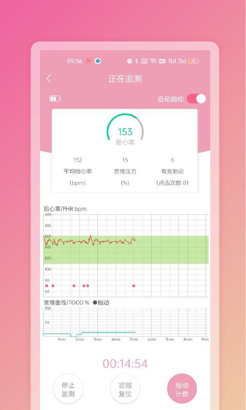 fetaphon home官方版下载,fetaphonhome,胎儿app,母婴app